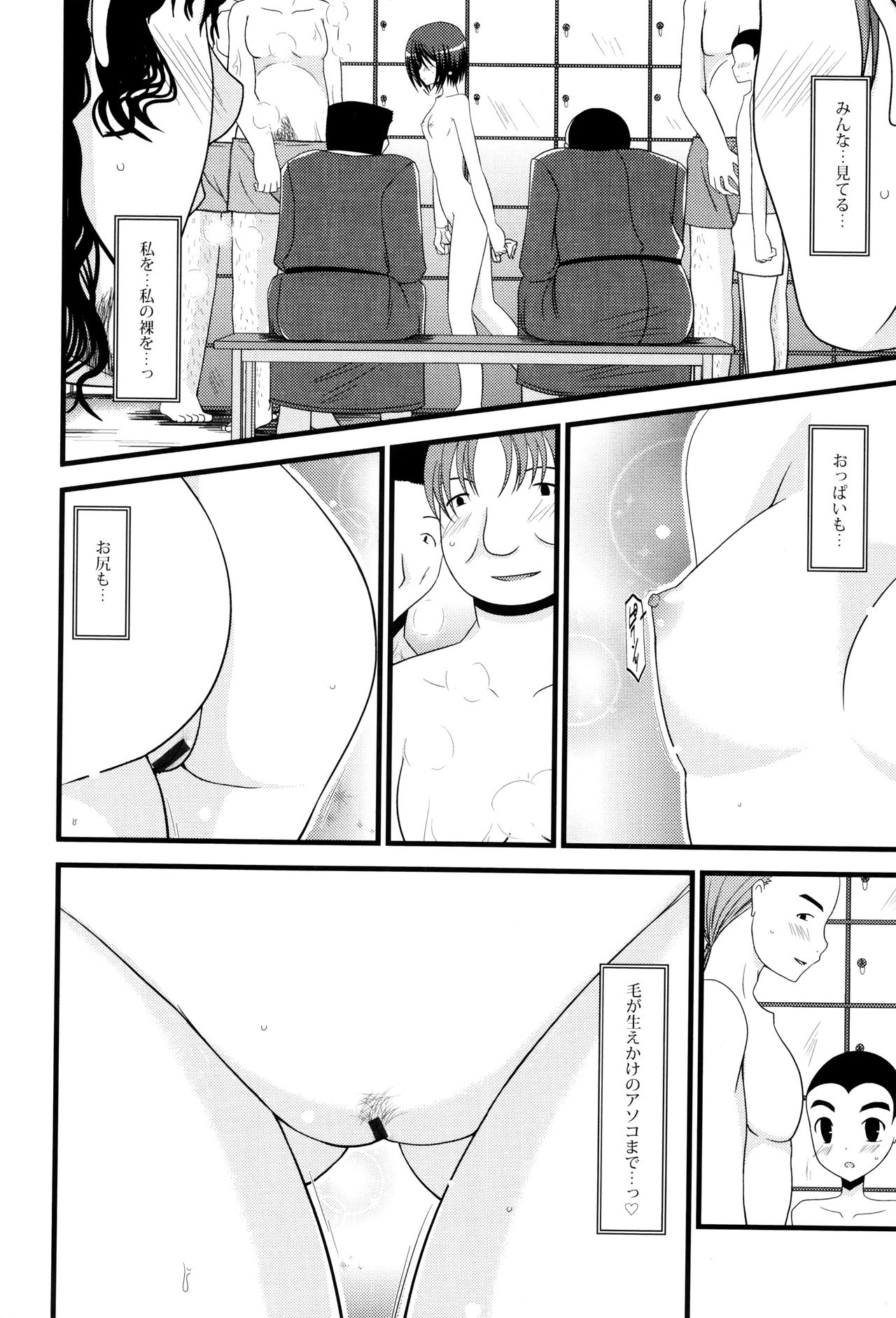 [茶琉] 露出少女遊戯 三島ひかるの性癖 上 + イラストカード