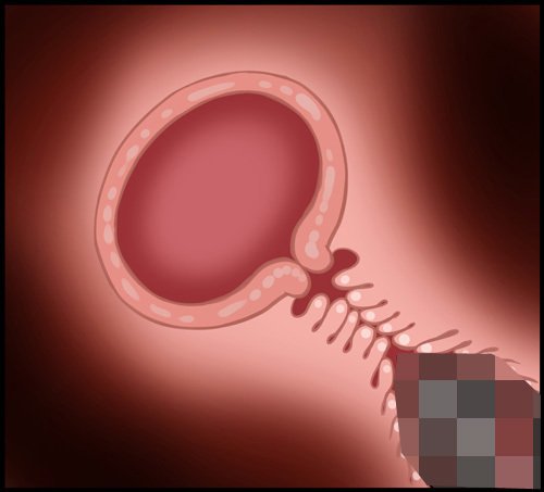 Core On Witches18をインストールする