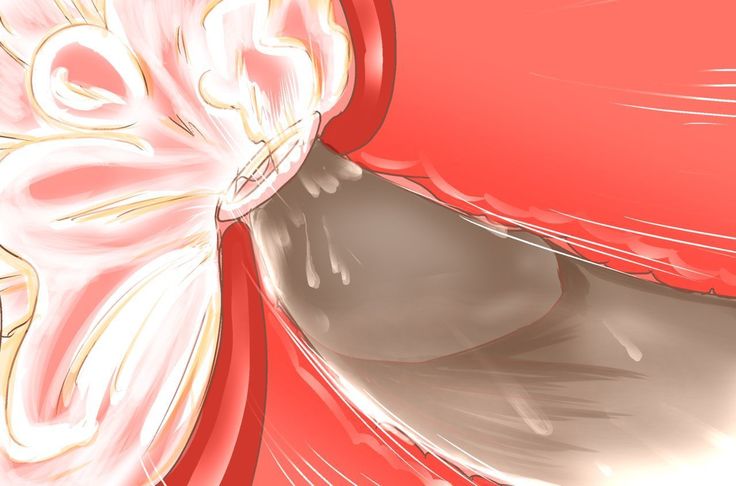 NTR-カッコールドクラブ