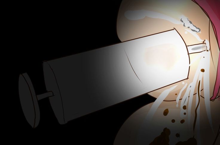 NTR-カッコールドクラブ