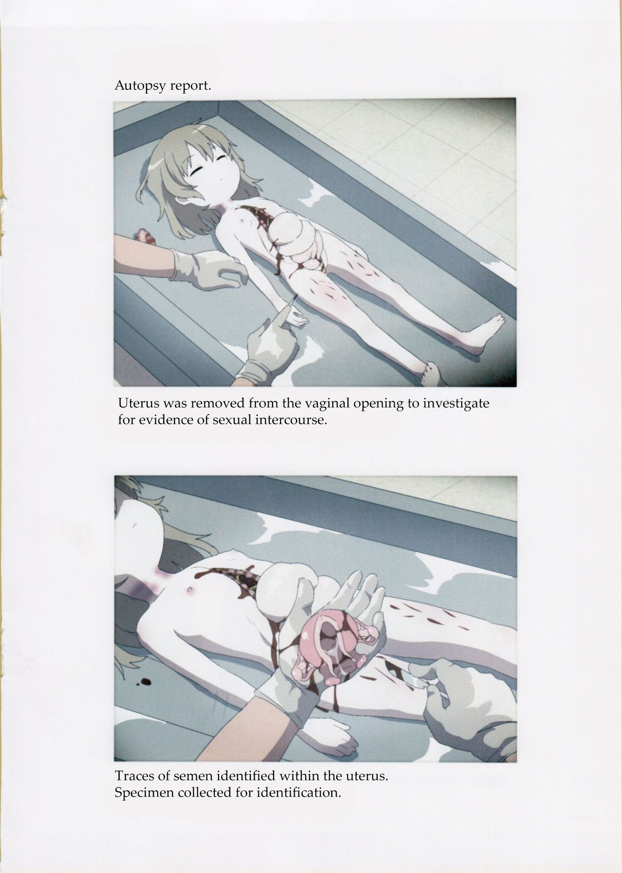 (C95) [02 (原崎)] 西荻窪少女殺害事件司法解剖記録 (鳩羽つぐ) [英訳]