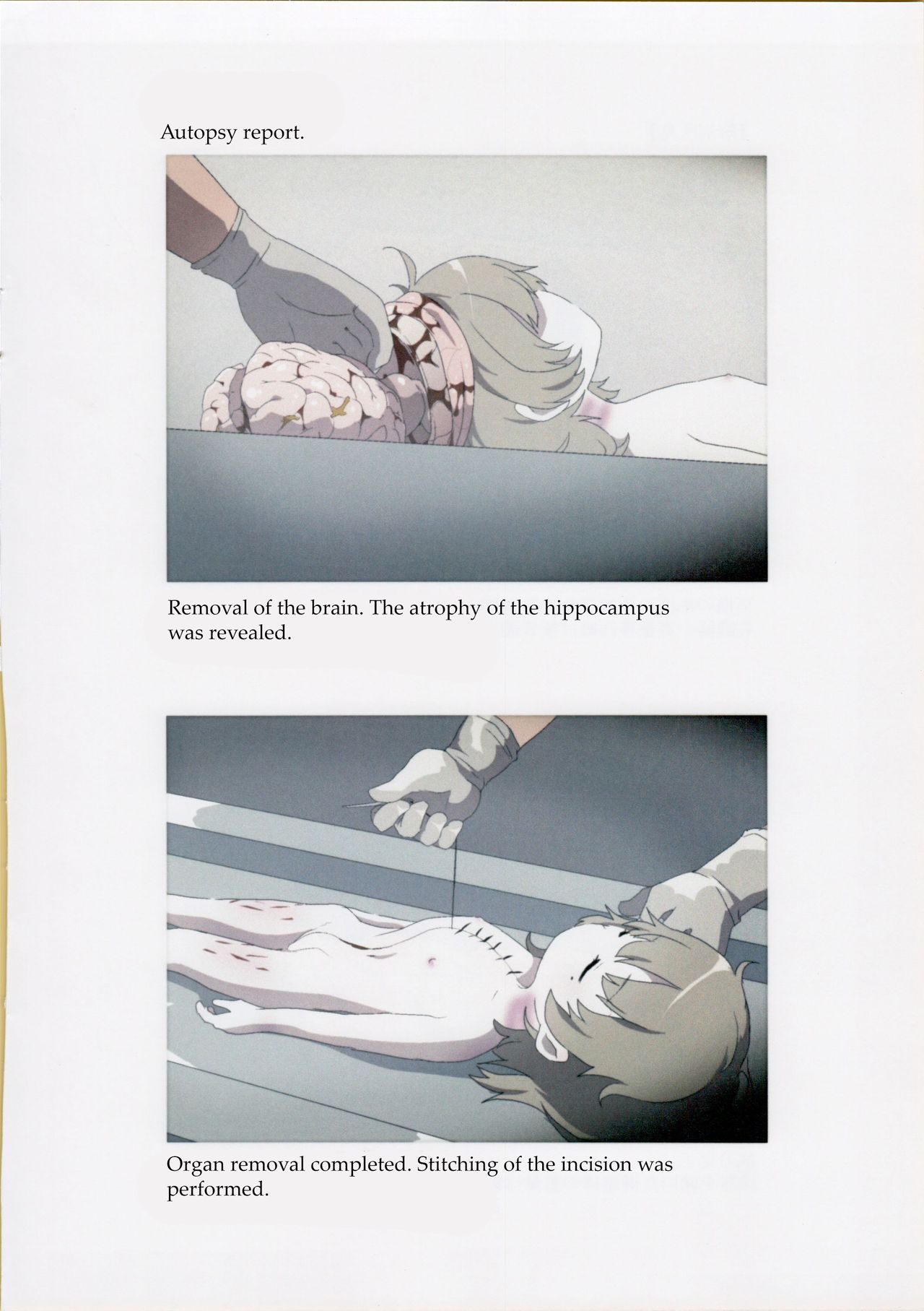 (C95) [02 (原崎)] 西荻窪少女殺害事件司法解剖記録 (鳩羽つぐ) [英訳]